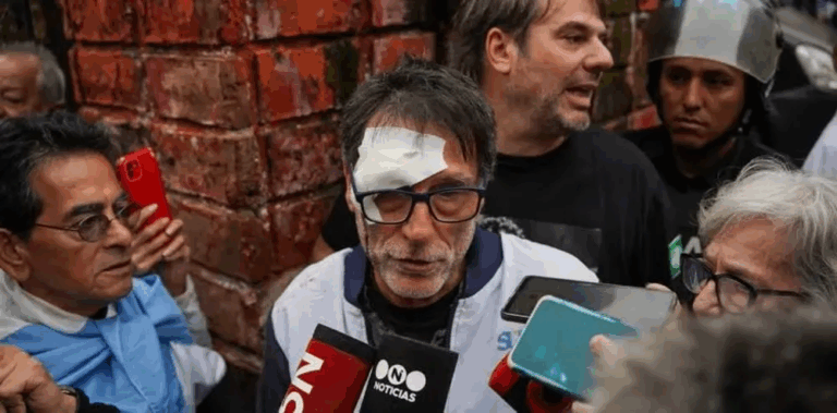 El Padre Paco habló tras sufrir la violenta represión en la marcha de los jubilados: «Es anecdótico, lo que me duele es el alma»